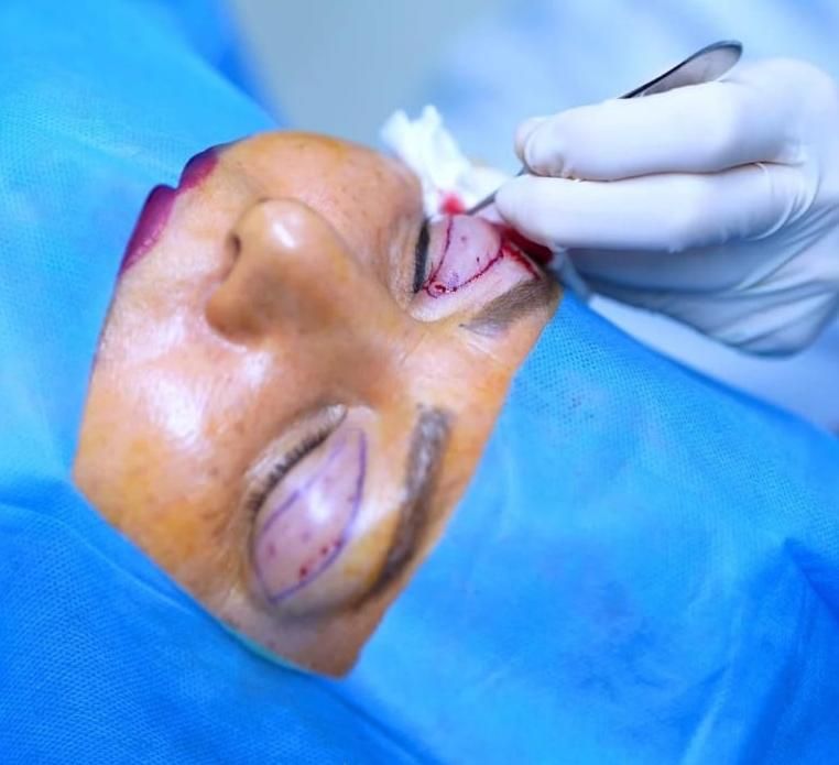 خدمات زیبایی و لیزر|خدمات آرایشگری و زیبایی|دهلران, |دیوار