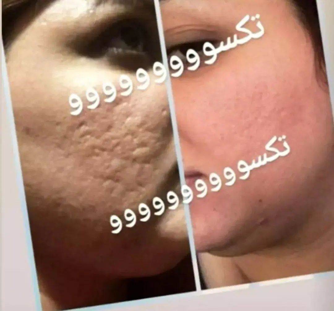 پاکسازی کبد و اصلاح مزاج لاغری پوست مو چاقی صورت|آرایشی، بهداشتی، درمانی|فردیس, شهرک ۱۱۰|دیوار