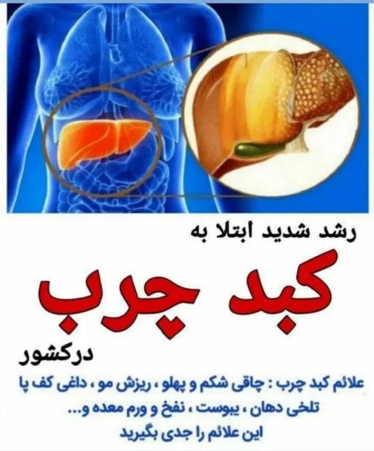 کبدچرب|آرایشی، بهداشتی، درمانی|مشهد, کلاهدوز|دیوار
