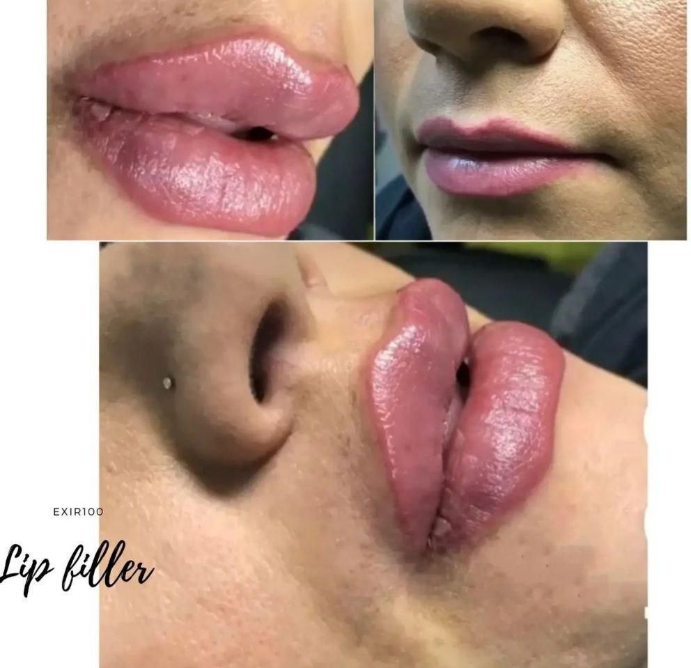 جشنواره تزریق ژل و بوتاکس و آموزش|خدمات آرایشگری و زیبایی|اصفهان, بهار آزادی|دیوار