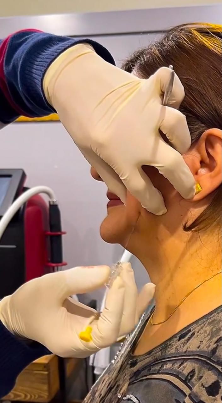 اِمبدینگ*کاشت نخ*میانبر لاغری۱۰۰٪|خدمات آرایشگری و زیبایی|اصفهان, مرداویج|دیوار