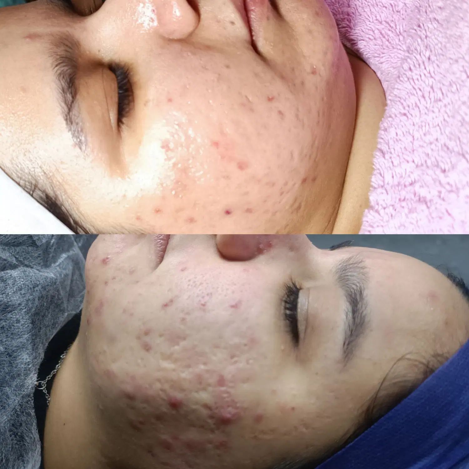 بهترین فیشیال کار در اقبال و وکیل ابادپاکسازی پوست|خدمات آرایشگری و زیبایی|مشهد, اقبال|دیوار