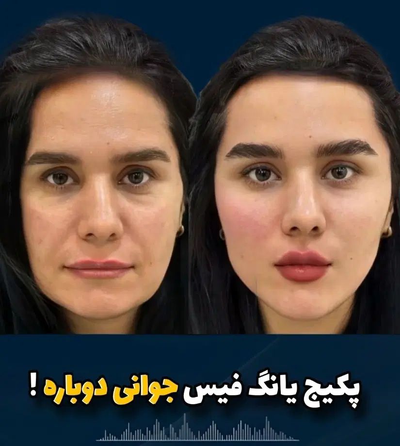 فیلر بادی باسن سینه بیکینی دست غبغب شکم دکتر زنان|خدمات آرایشگری و زیبایی|مشهد, هفت تیر (آب و برق)|دیوار