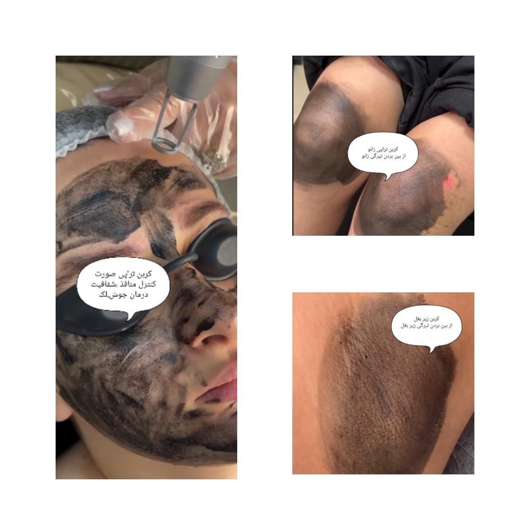 آلگاپیل،فیشال (خانمها و آقایان)|خدمات آرایشگری و زیبایی|یاسوج, |دیوار