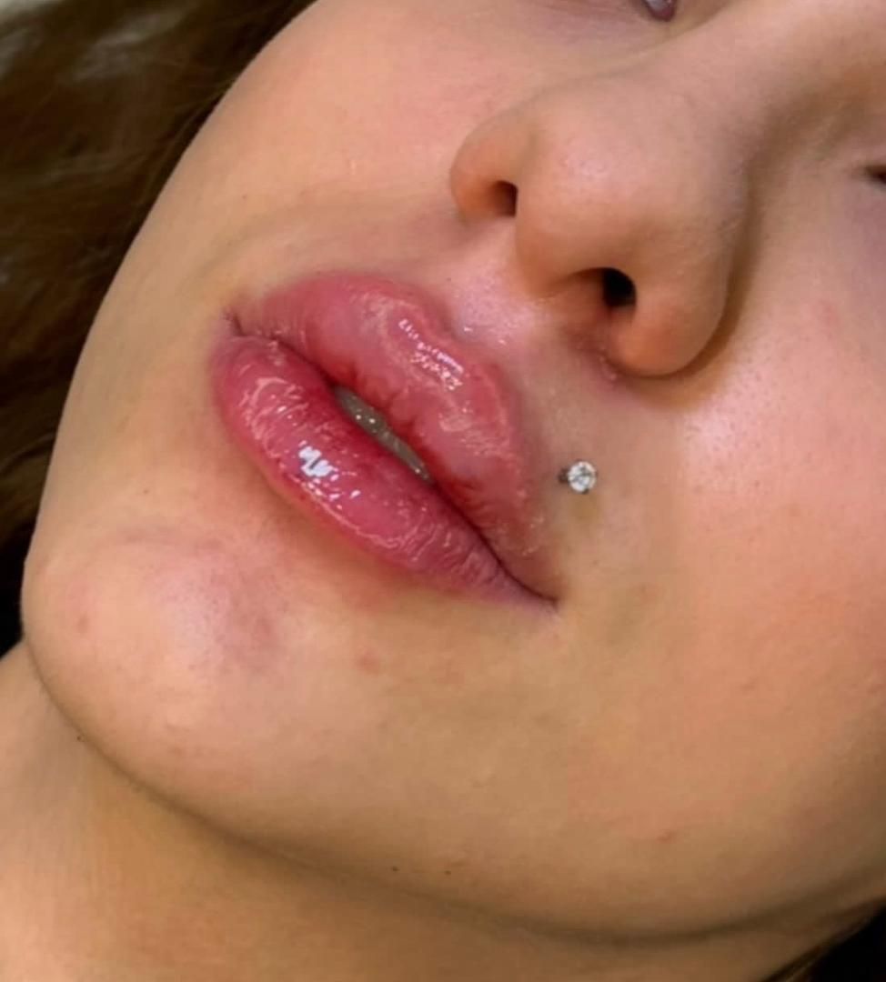 نیازمند مدل خانم برای فیلر،بوتاکس و...بدون پرداختی|خدمات آرایشگری و زیبایی|تهران, قلهک|دیوار