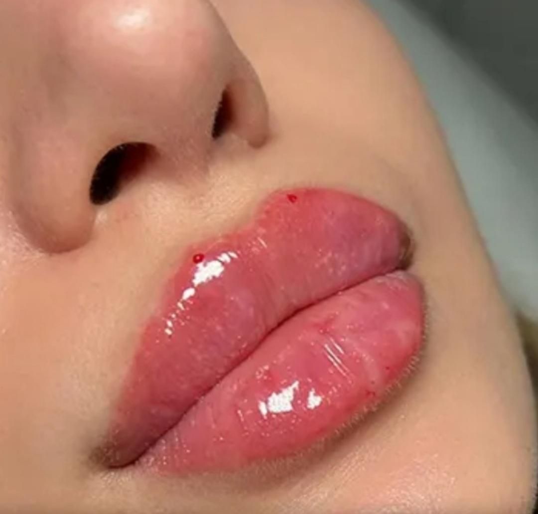 تزریق ژل فیلر بوتاکس مزوتراپی مو ابرو صورت پی آرپی|خدمات آرایشگری و زیبایی|اهواز, نادری|دیوار