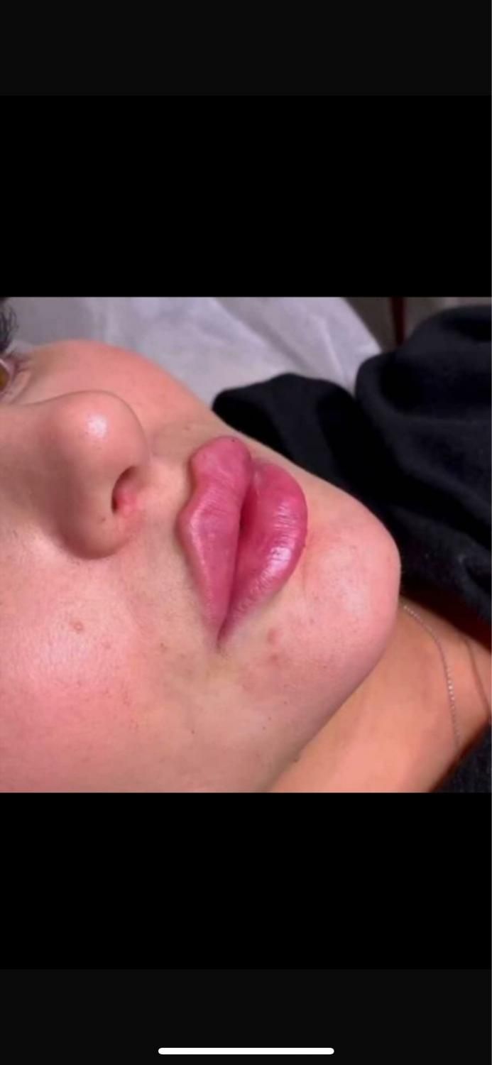 جشنواره تابستانه تزریق ژل و بوتاکس|خدمات آرایشگری و زیبایی|کرج, خرمدشت|دیوار