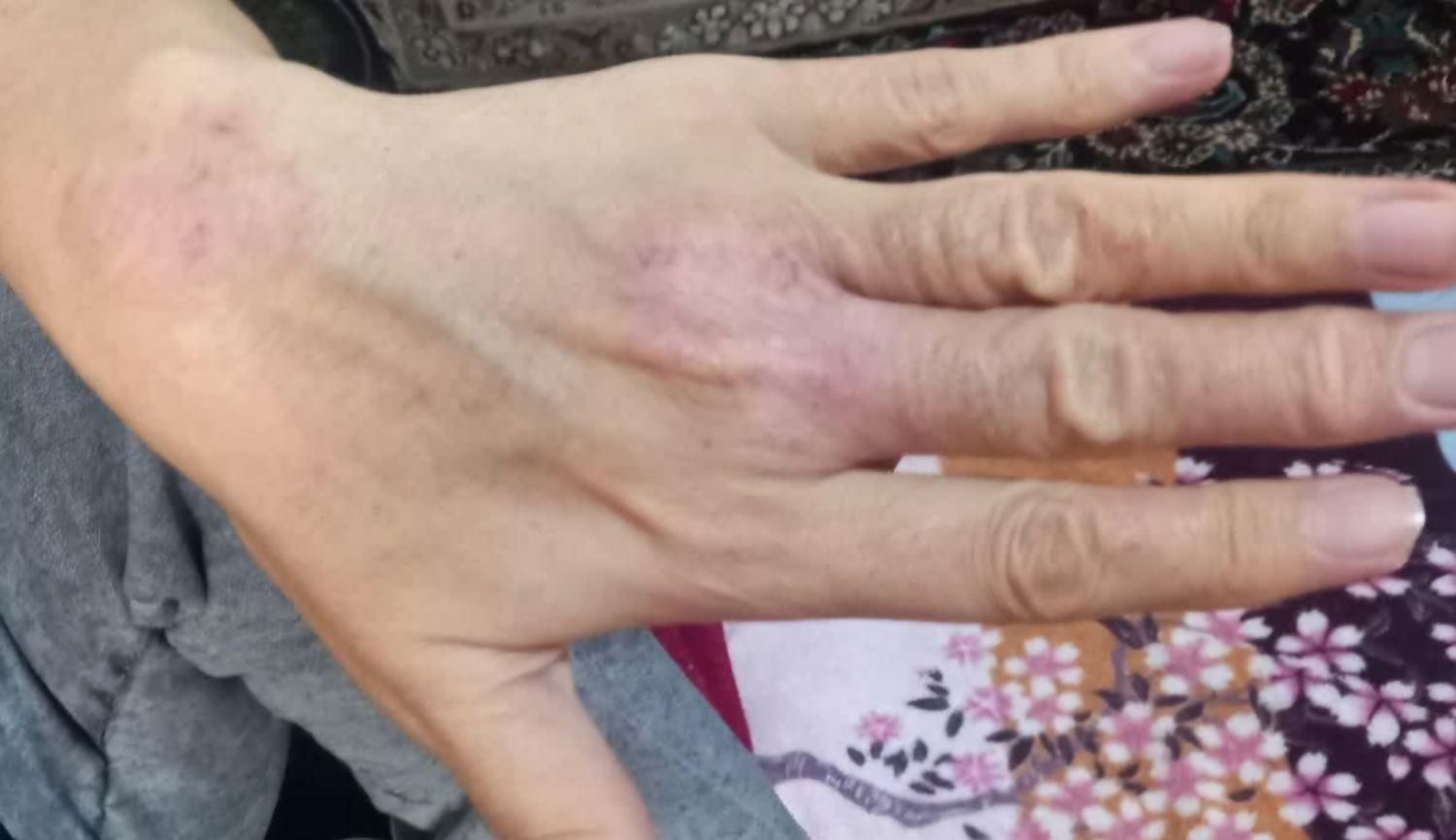 طب سنتی گیاهی ،،بهرامی|آرایشی، بهداشتی، درمانی|ساوه, |دیوار