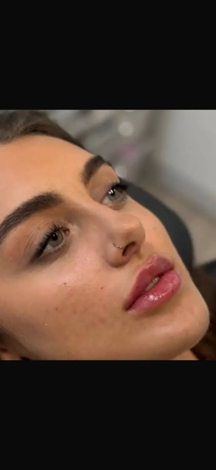 فیلر ژل لب تخصصی بوتاکس پزشک کلینیک زیبایی|خدمات آرایشگری و زیبایی|تهران, تهرانسر مرکزی|دیوار