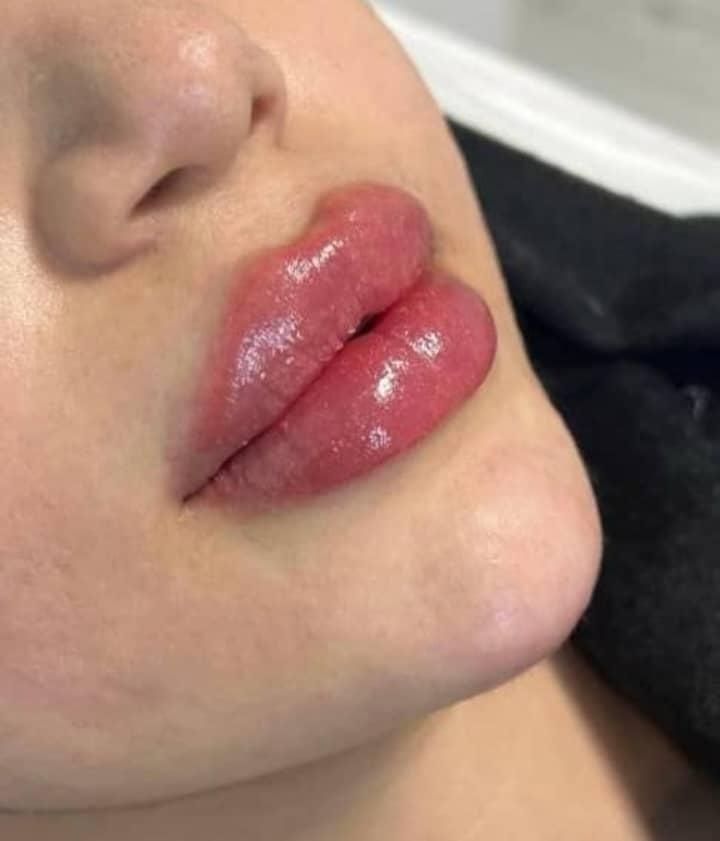 آموزش ژل وبوتاکس2900.چال گونه.آموزش نخ2500.ژل بادی|خدمات آموزشی|اهواز, گلستان|دیوار