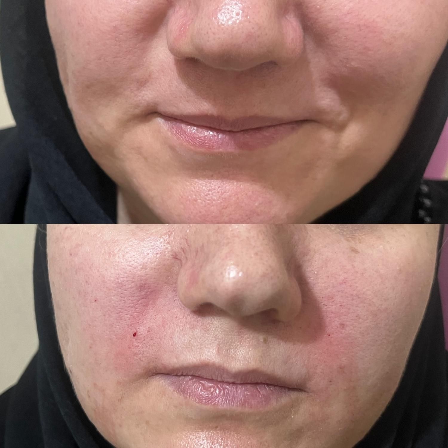 ژل و بوتاکس|خدمات آرایشگری و زیبایی|چالوس, |دیوار