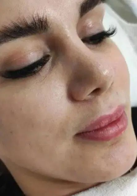 آف باورنکردنی فیشیال فوق پیشرفته اولین‌باردرایذه|خدمات آرایشگری و زیبایی|ایذه, |دیوار