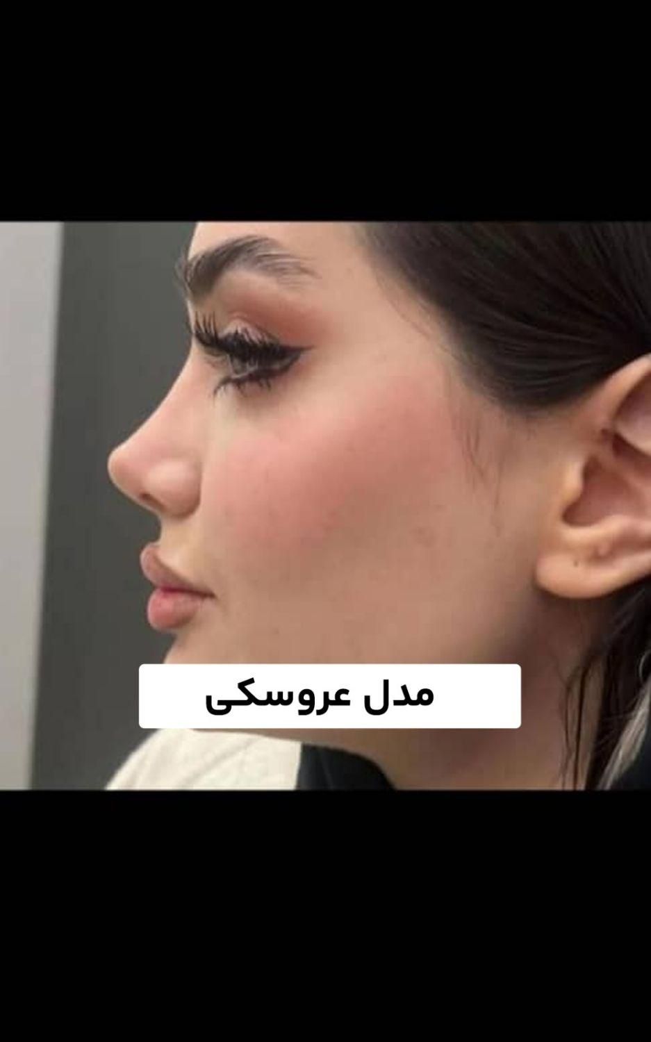 تخفیف عمل جراحی بینی لیفت لیپو ابدو کاشت ابرو مو|خدمات آرایشگری و زیبایی|کرج, عظیمیه|دیوار