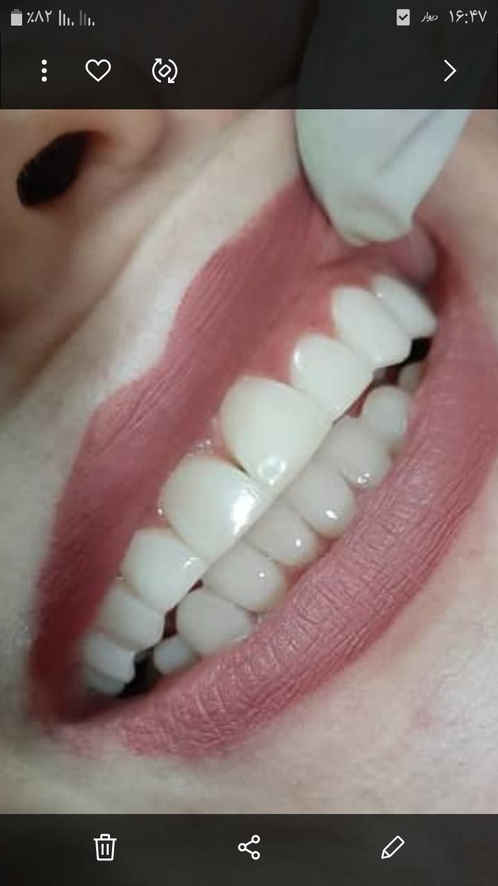 خدمات دندانپزشکی طرح همایتی(نیمه رایگان)|خدمات آرایشگری و زیبایی|کرمانشاه, |دیوار