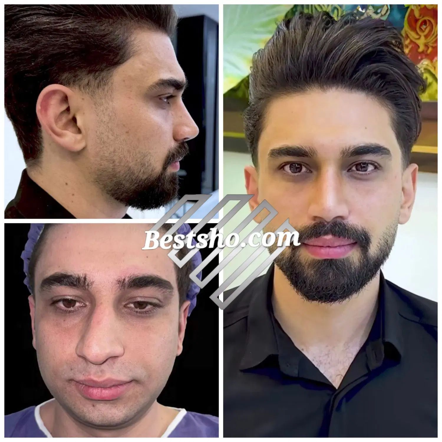 جراحی عمل بینی لیپو ابدو لیفت پروتز پیکرتراشی|خدمات آرایشگری و زیبایی|تهران, تهران پارس|دیوار