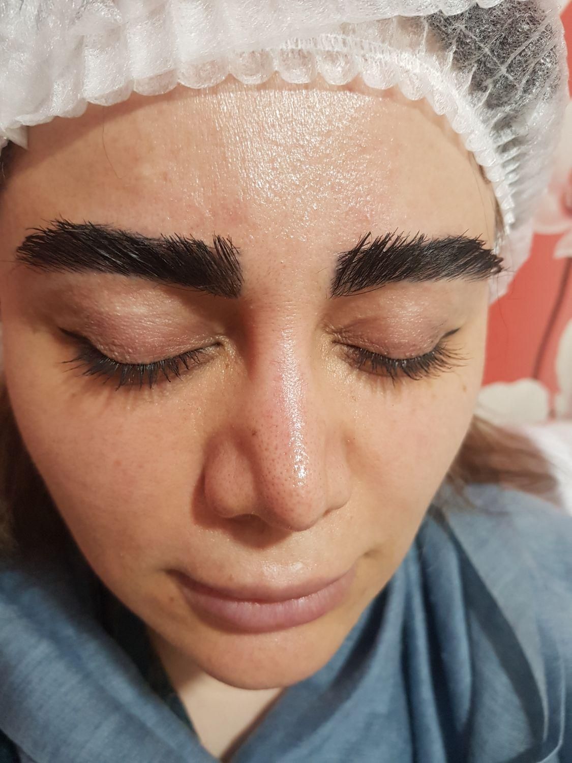 لیزر، بلفارو، تزریق چربی، تخلیه شکم ،ژل بوتاکس نخ|خدمات آرایشگری و زیبایی|تهران, خاک سفید|دیوار