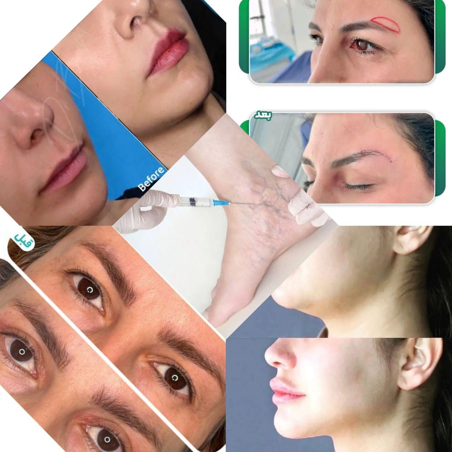 جراحی زیبایی|خدمات آرایشگری و زیبایی|قزوین, |دیوار