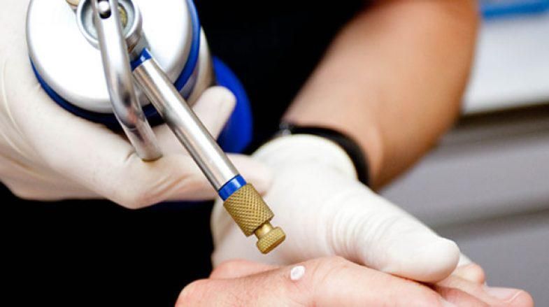 درمان زگیل پوستی/کرایو تراپی و لیزر/hpv|خدمات آرایشگری و زیبایی|اهواز, کیانپارس |دیوار