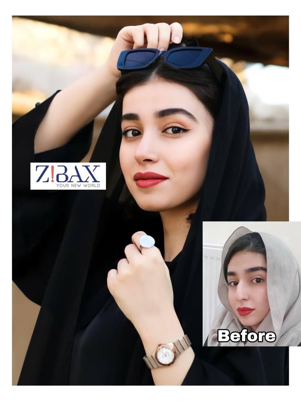 جراحی بینی در شیراز/نوبتگیری +وام+مشاوره|خدمات آرایشگری و زیبایی|لار, |دیوار
