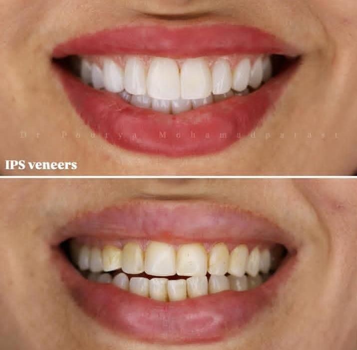 دندانپزشکی قسطی در مطب لنگرود|خدمات آرایشگری و زیبایی|لاهیجان, گلستان|دیوار