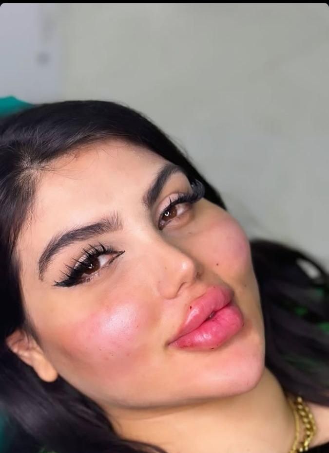 جشنواره تزریق ژل و بوتاکس/آموزش تخصصی/فشیال تخصصی|خدمات آرایشگری و زیبایی|اندیشه, اندیشه فاز ۱|دیوار