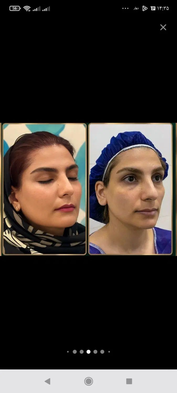 آموزش جراحی صورت کاشت ابرو بلفاروپلاسی ساکشن غبغب|خدمات آموزشی|اصفهان, خواجو|دیوار