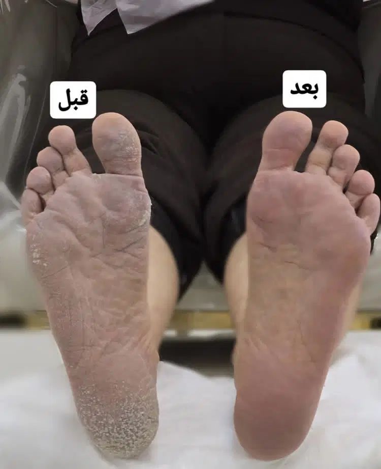 پدیکور و کفسابی-کاشت و ترمیم و ژلیش-لمینت|خدمات آرایشگری و زیبایی|کرج, اتحاد|دیوار
