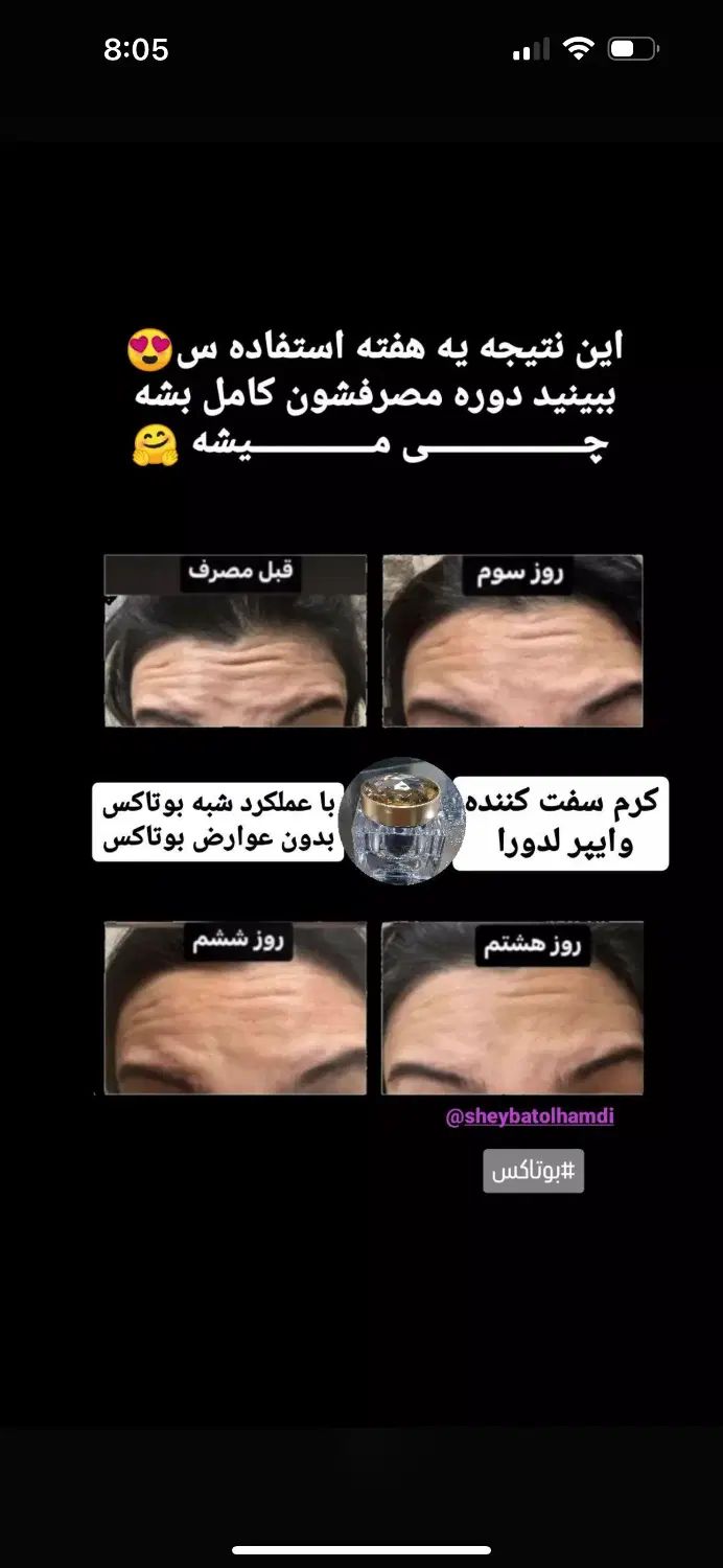 لیفت وایپر|آرایشی، بهداشتی، درمانی|تهران, شهرک محلاتی|دیوار