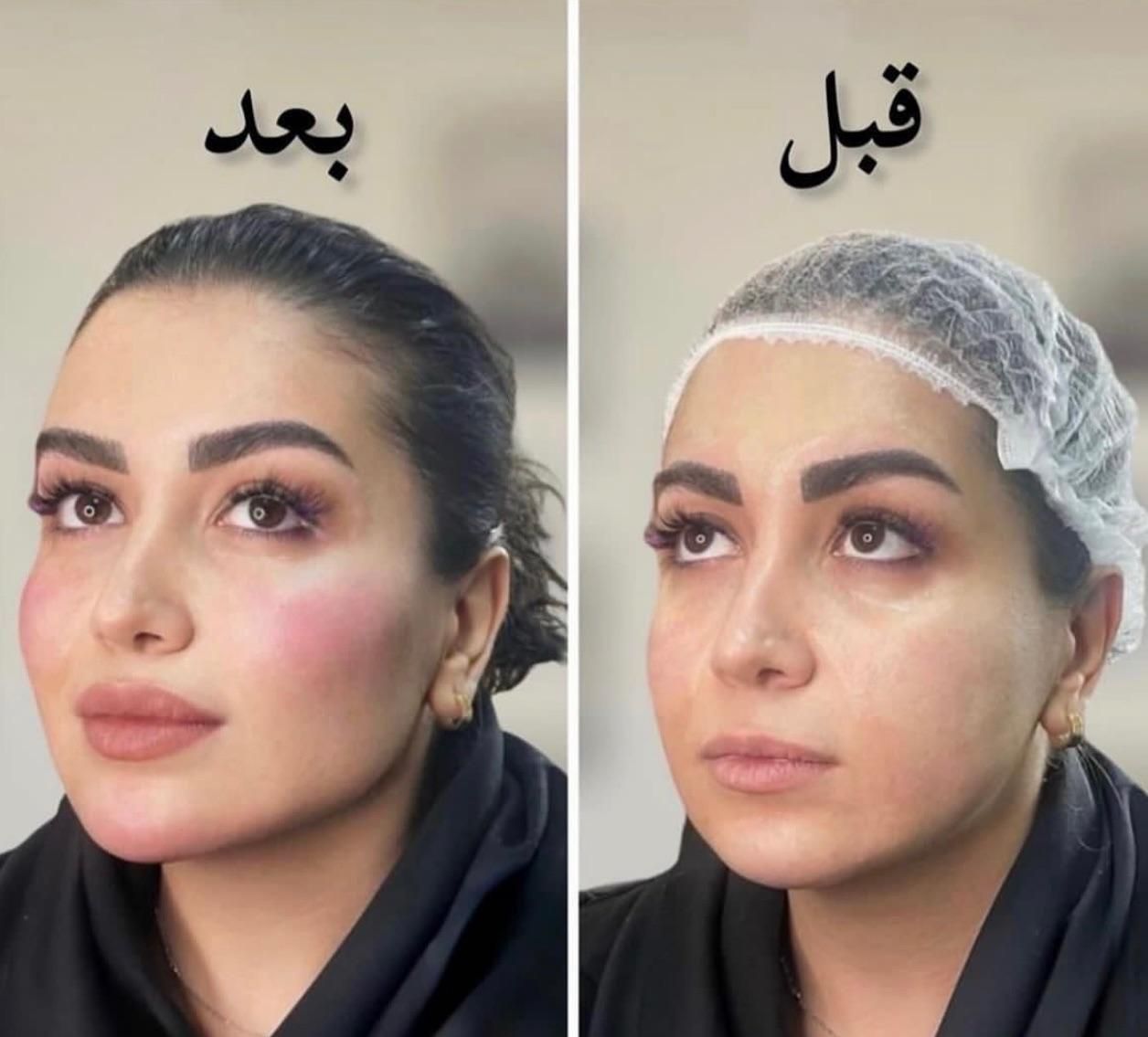 تخفیفات۵۰ درصدی ژل،بوتاکس،انزیم کیلینیک هستی|خدمات آرایشگری و زیبایی|کرمانشاه, |دیوار