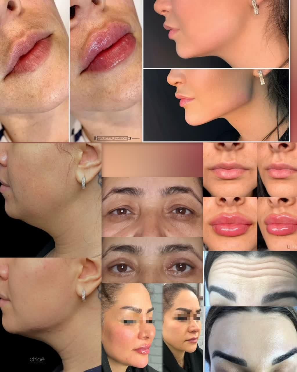 خدمات زیبایی تخصصی با قیمت‌های استثنایی|خدمات آرایشگری و زیبایی|مشهد, راهنمایی|دیوار