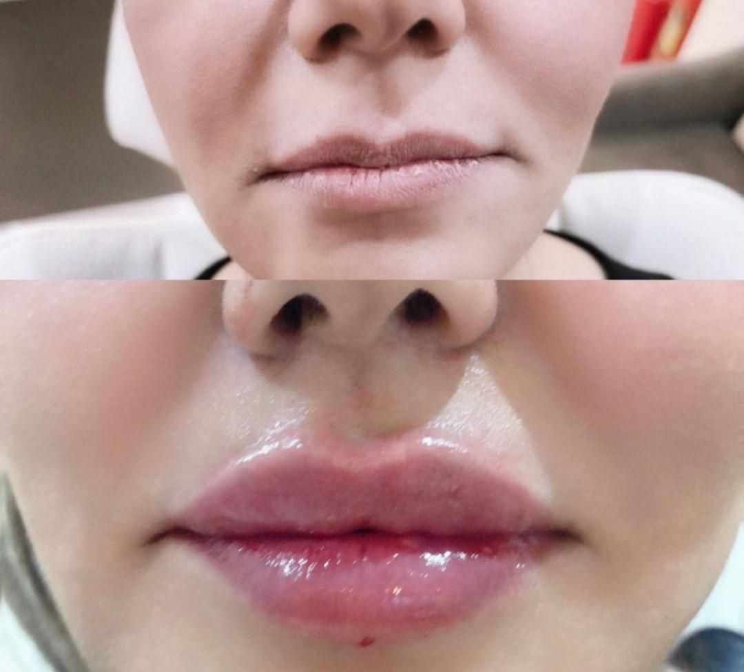 خدمات ژل و بوتاکس بانوان و آقایان|خدمات آرایشگری و زیبایی|پرند, فاز ۵|دیوار