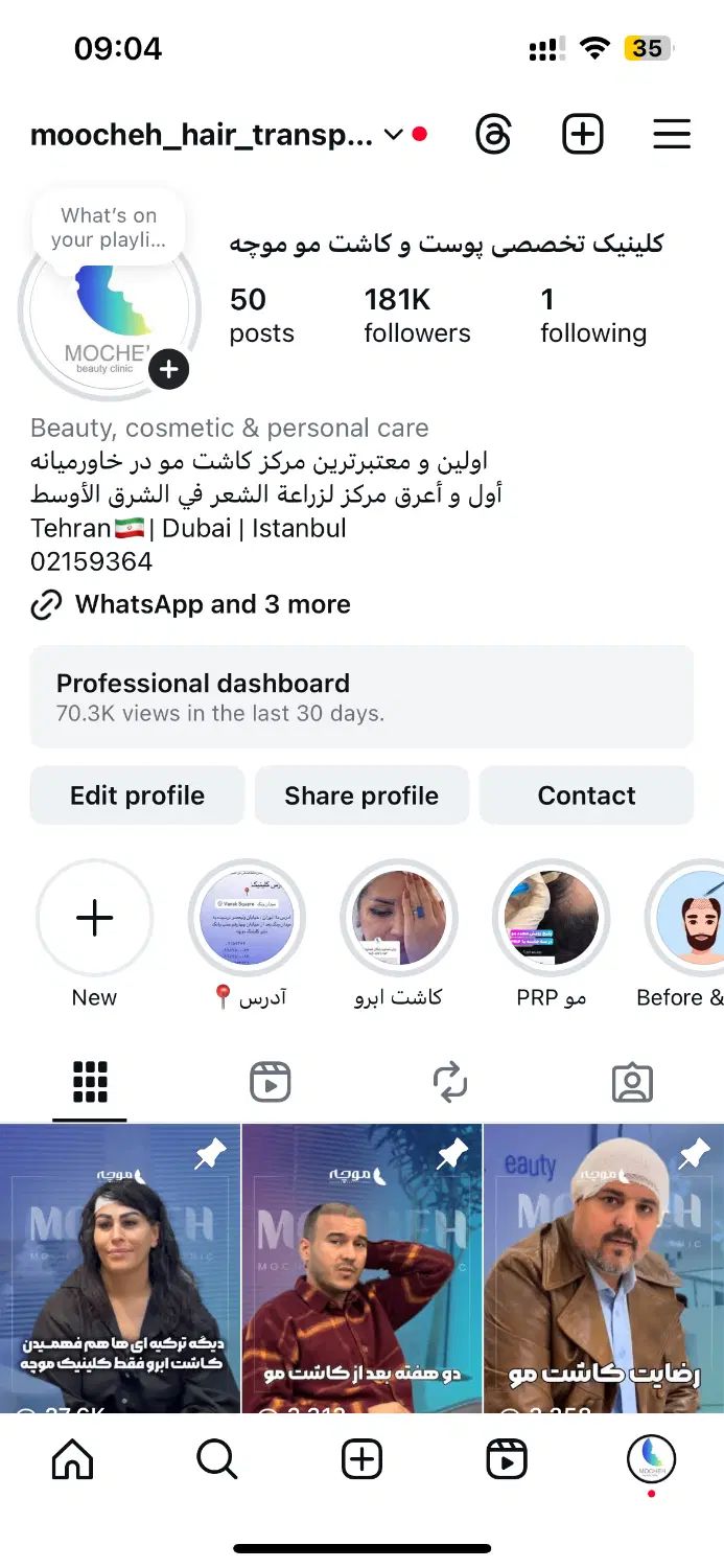 کاشت مو بدون جراحی یک روزه ضمانت مادام العمر|خدمات آرایشگری و زیبایی|تهران, ونک|دیوار