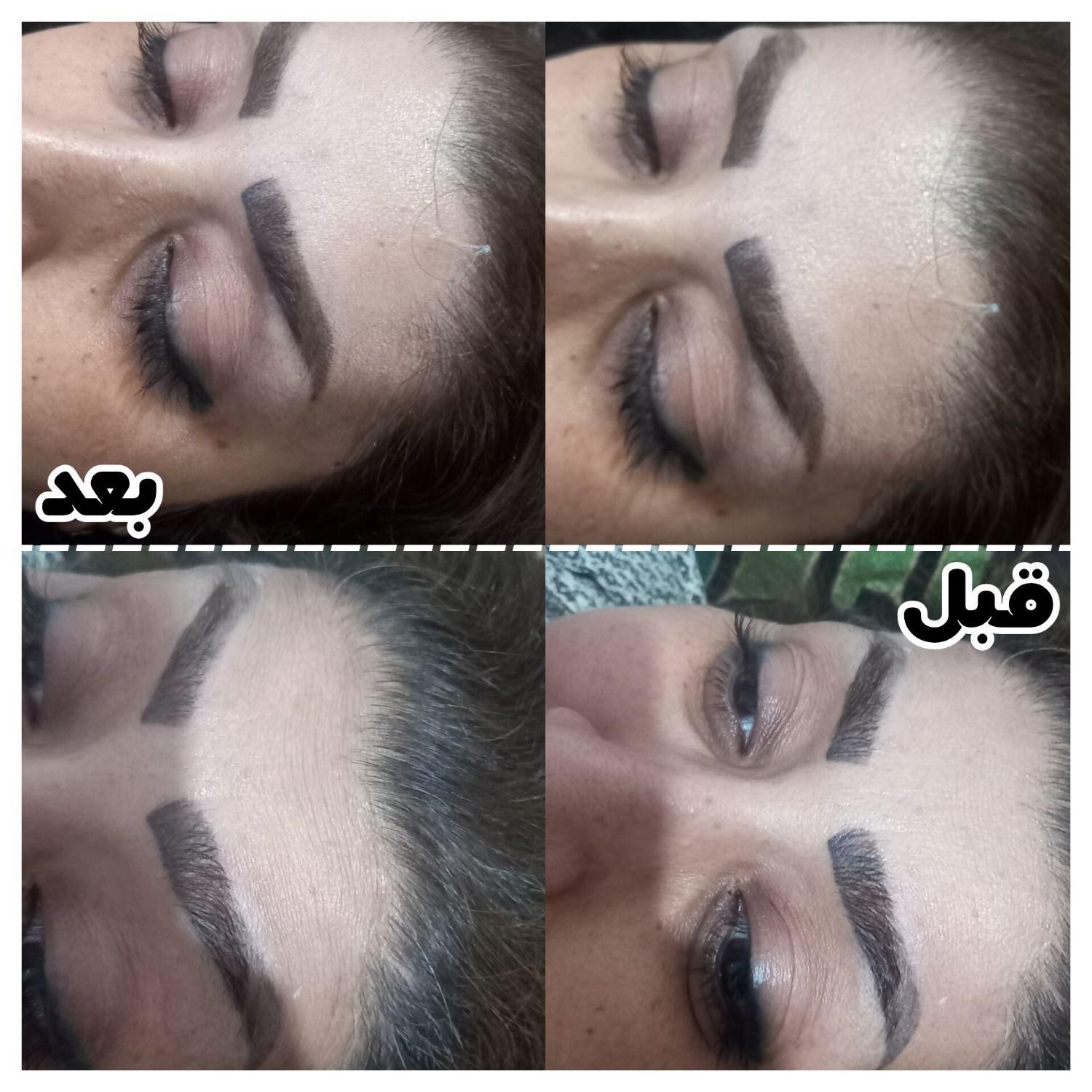 اف ۵۰٪ژل و بوتاکس و مزو...|خدمات آرایشگری و زیبایی|اهواز, اهواز|دیوار