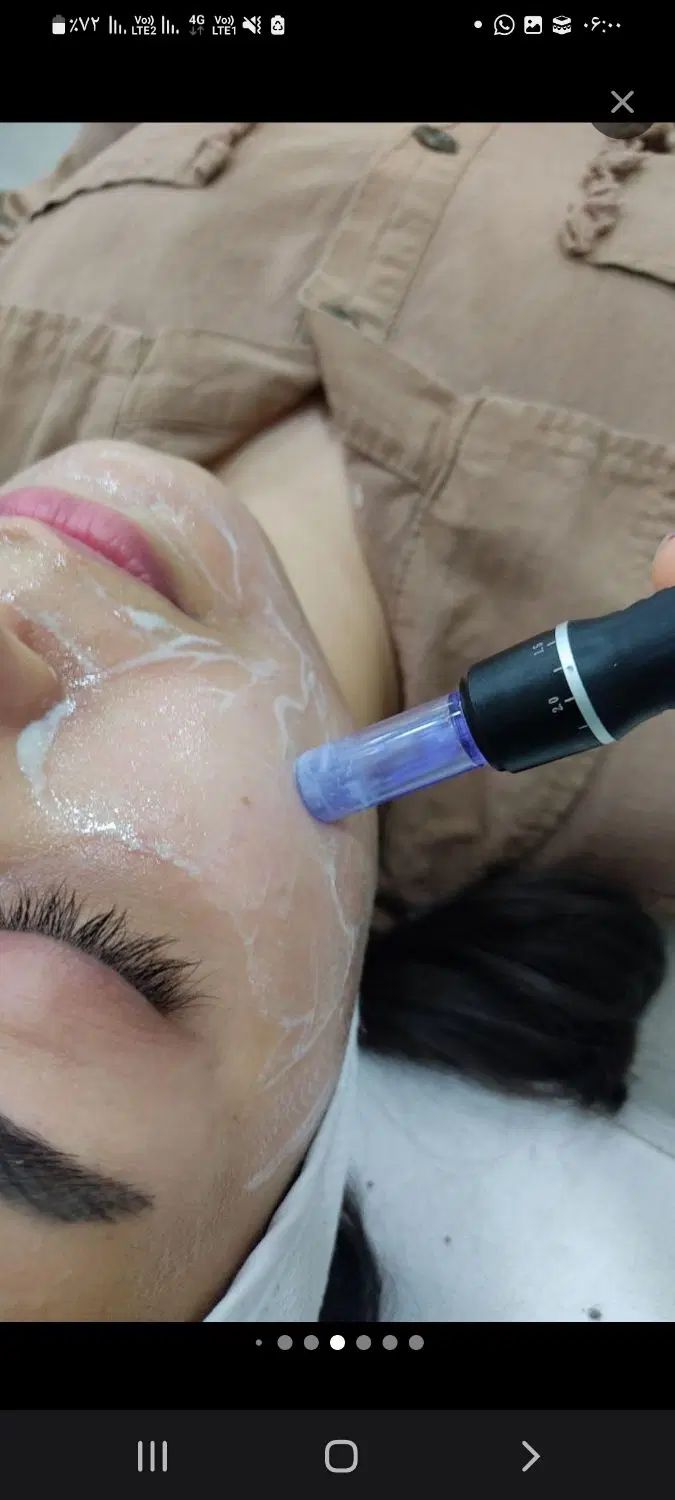خدمات و آموزش فیشیال مزوتراپی میکروندلینگ|خدمات آرایشگری و زیبایی|اهواز, حصیرآباد|دیوار