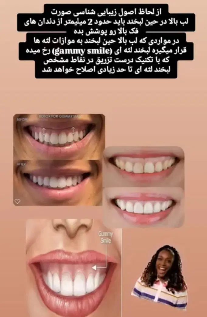 فشیال تخصصی تحت نظرپزشک..مشاوره مراقبت های پوست مو|خدمات آرایشگری و زیبایی|آبادان, |دیوار