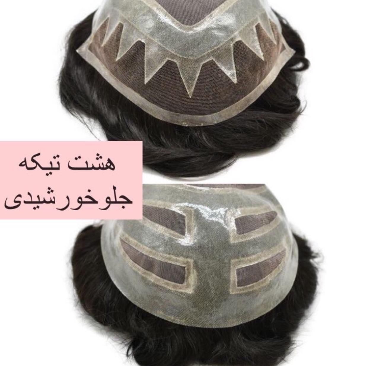 فروش پروتز مو،نصب پروتز مو،ترمیم پروتز مو،فروش چسب|آرایشی، بهداشتی، درمانی|رشت, گلسار|دیوار