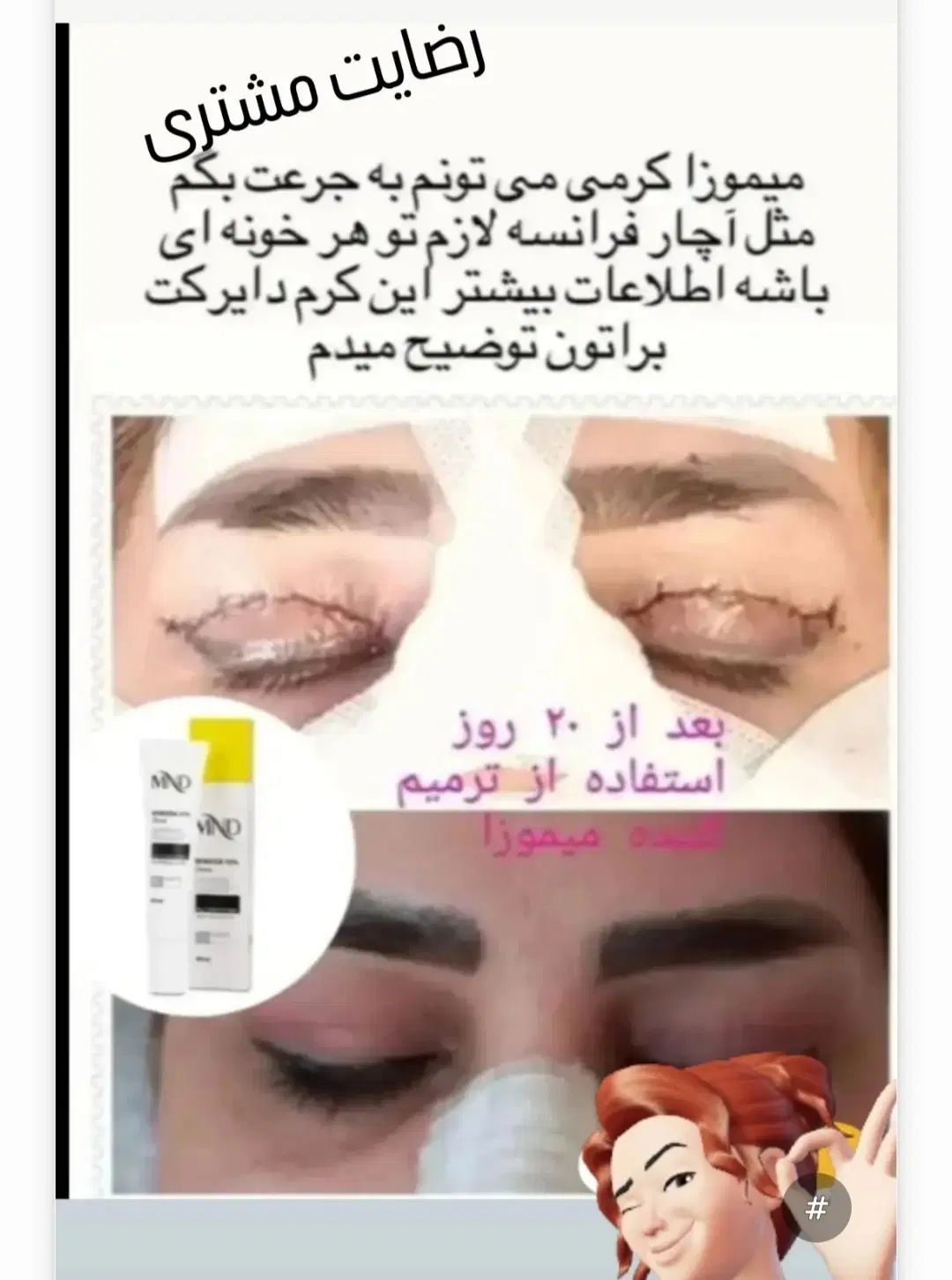 کرم میموزا|آرایشی، بهداشتی، درمانی|تهران, فلاح|دیوار