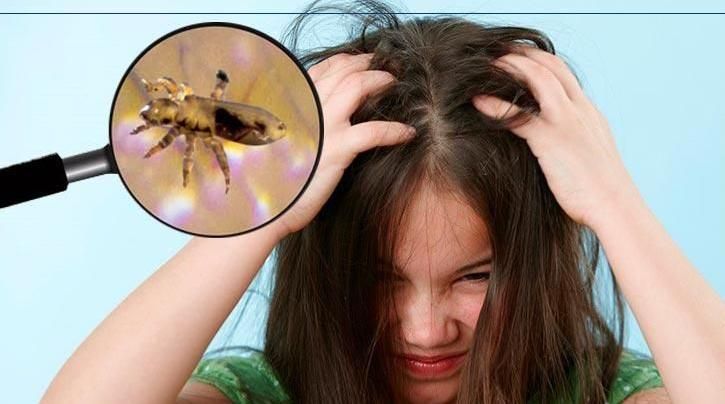 پاکسازی کامل مو بادستگاه تخصصی ضد شپش وموخوره گیری|خدمات آرایشگری و زیبایی|نیشابور, هفده شهریور|دیوار