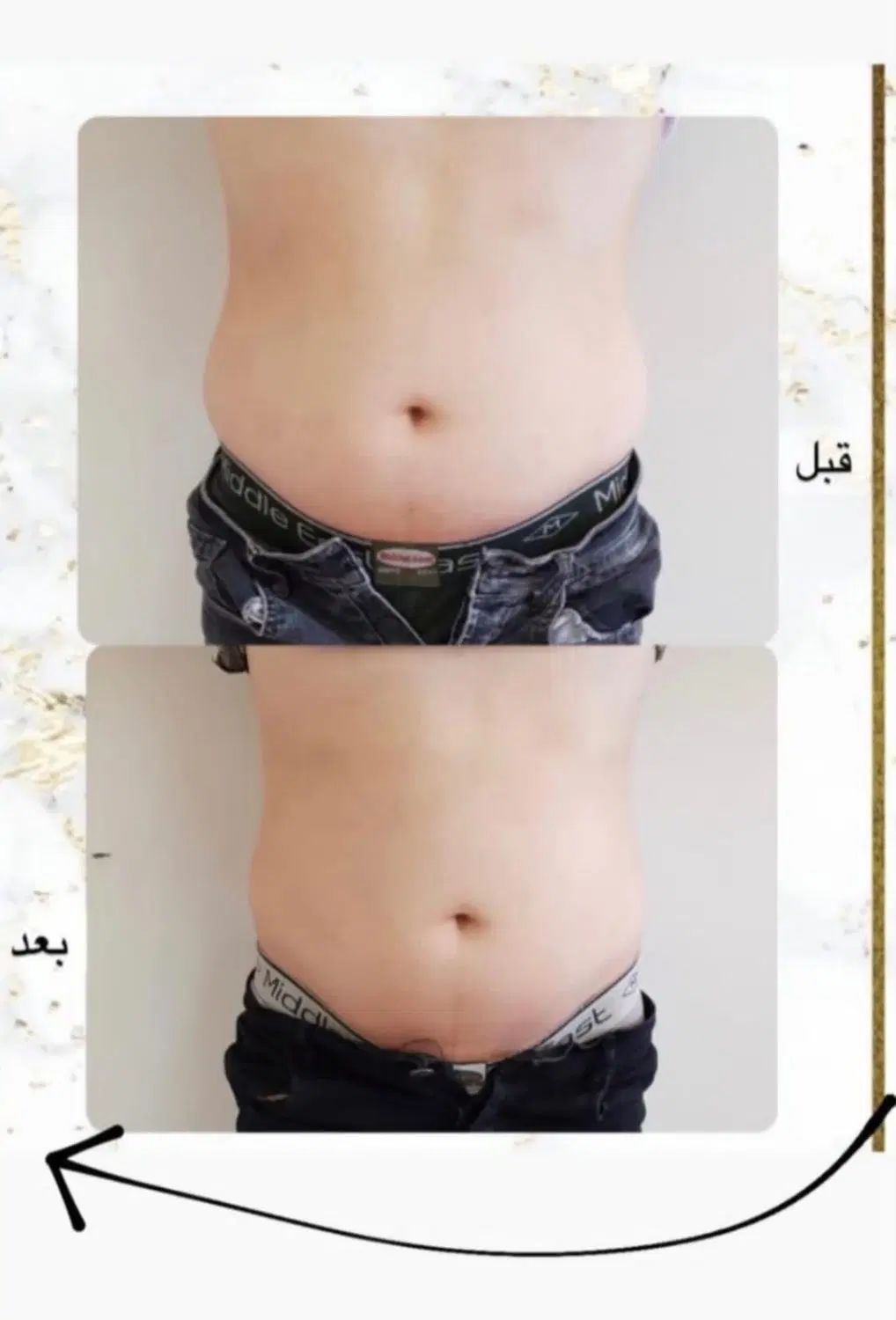 لاغری با دستگاه‌های پیشرفته و زیر نظر پزشک|خدمات آرایشگری و زیبایی|کرج, برغان|دیوار