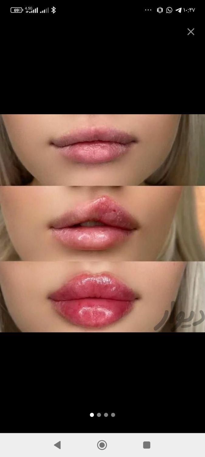 جشنواره اگزوزوم، فیلر بادی نخ،ژل،پی ارپی|خدمات آرایشگری و زیبایی|تهران, سعادت‌آباد|دیوار