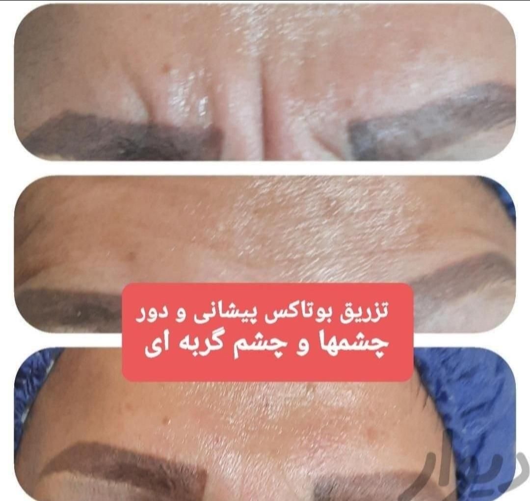 آموزش خدمات زیبایی  تزریق ژل .فیلر .بوتاکس .چربی|خدمات آموزشی|رشت, گلسار|دیوار