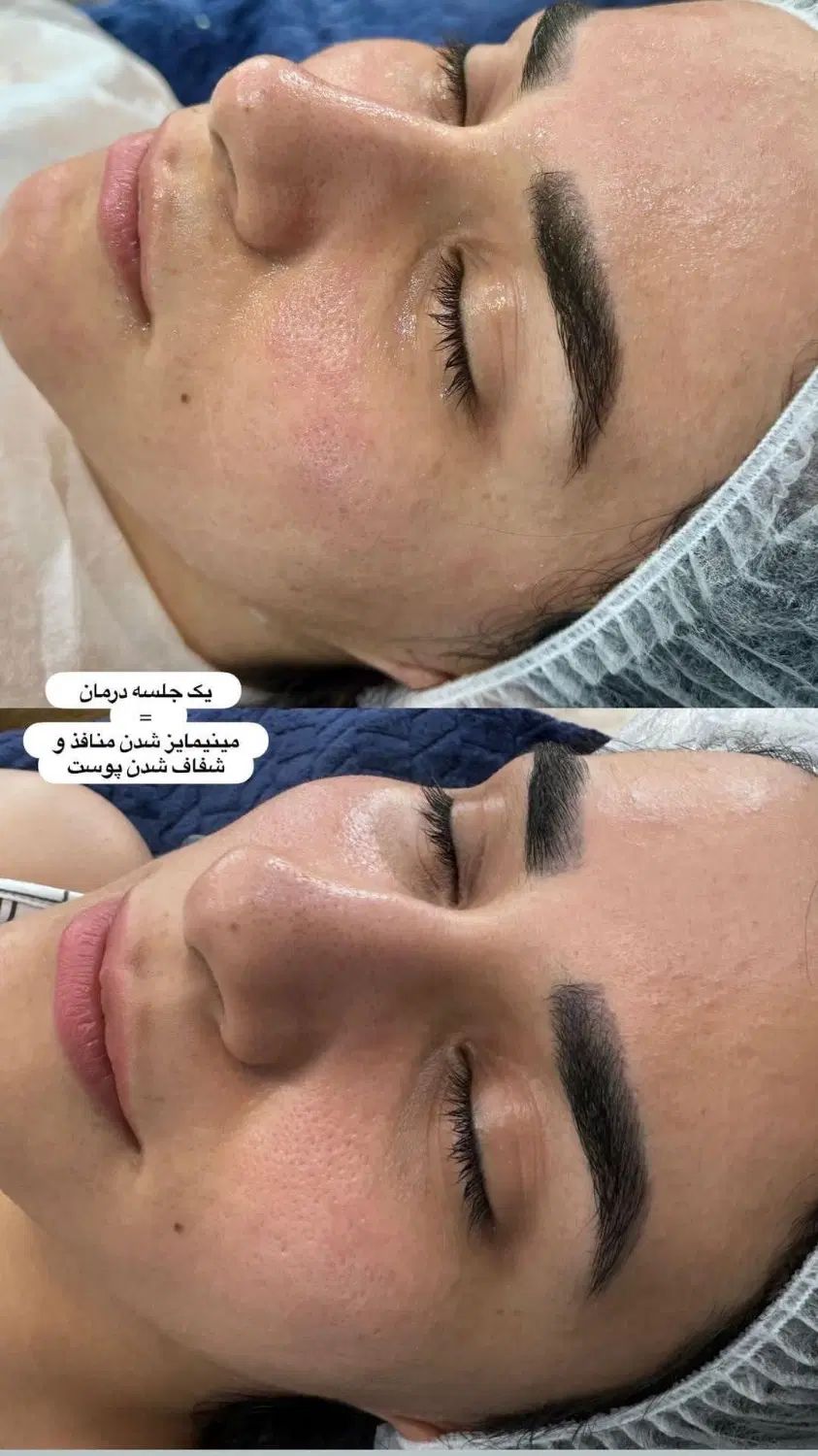 فیشیال پاکسازی حرفه ای با جدید ترین متد روز دنیا|خدمات آرایشگری و زیبایی|اهواز, کیانپارس |دیوار