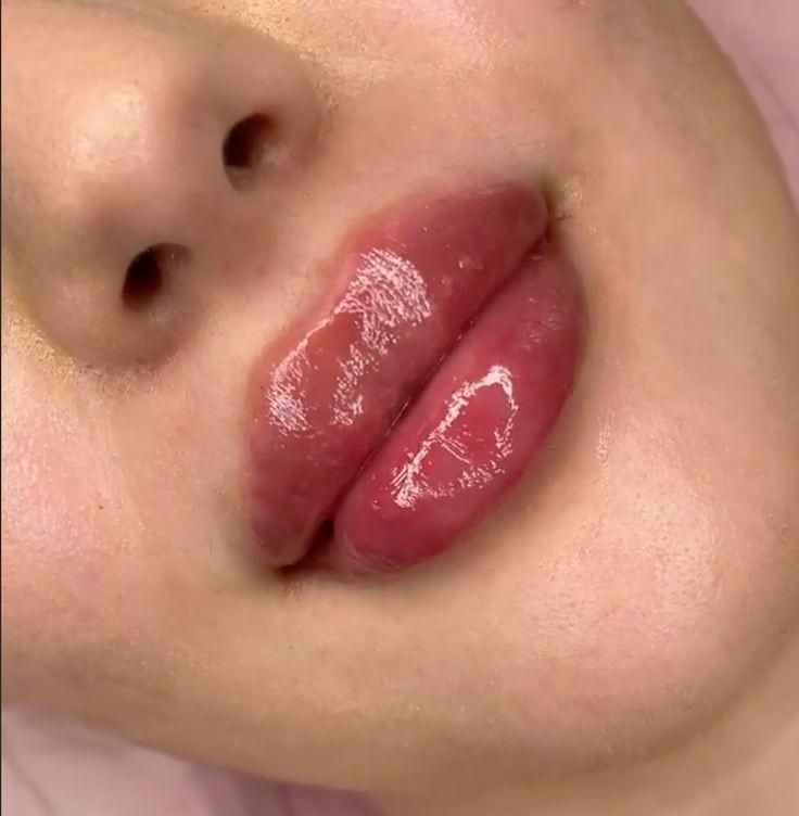 مدل تزریق ژل و بوتاکس و آموزش در کلینیک زیبایی|خدمات آرایشگری و زیبایی|کرج, چهارصد دستگاه|دیوار