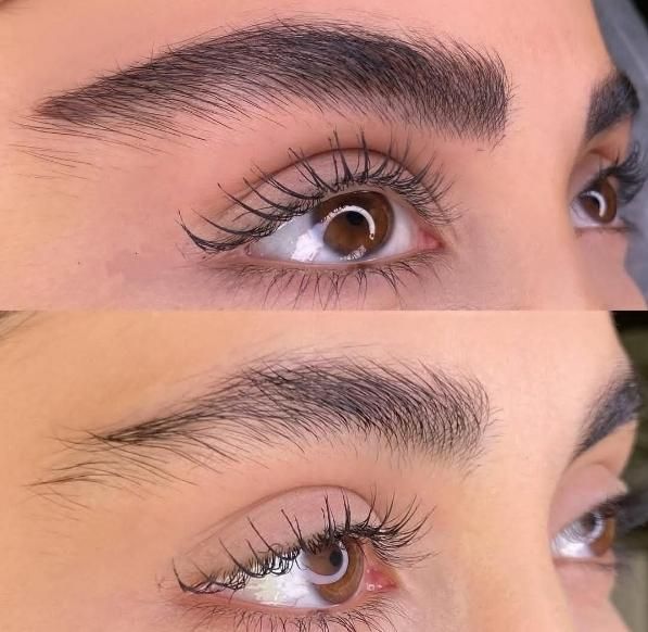 میکروبلیدینگ فیبروز|خدمات آرایشگری و زیبایی|بم, |دیوار