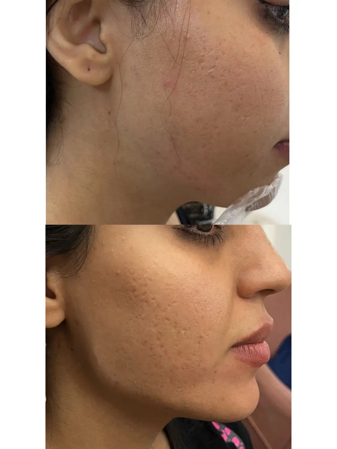 خدمات تزریق ژل و بوتاکس|خدمات آرایشگری و زیبایی|مشهد, عسگریه|دیوار