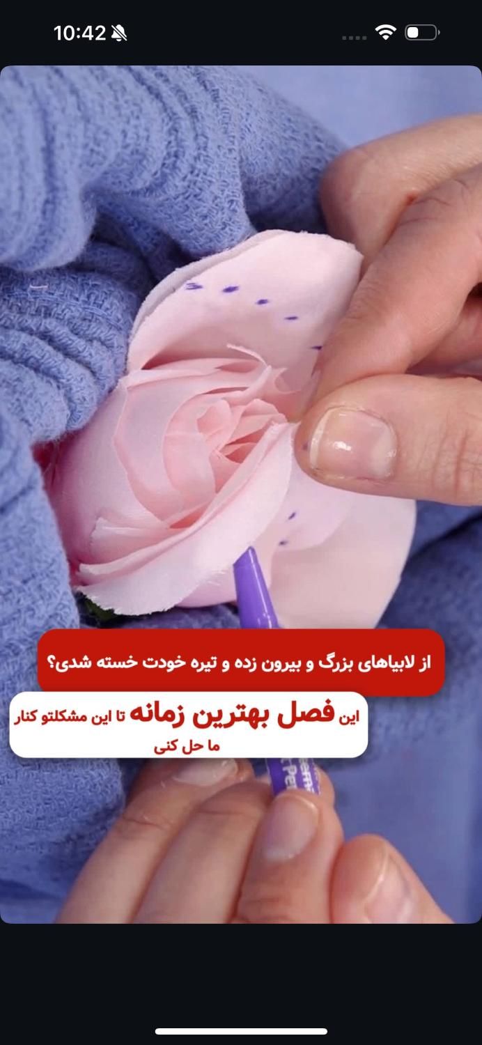 جراحی زنان لابیاپلاستی|خدمات آرایشگری و زیبایی|تهران, عبدل‌آباد|دیوار