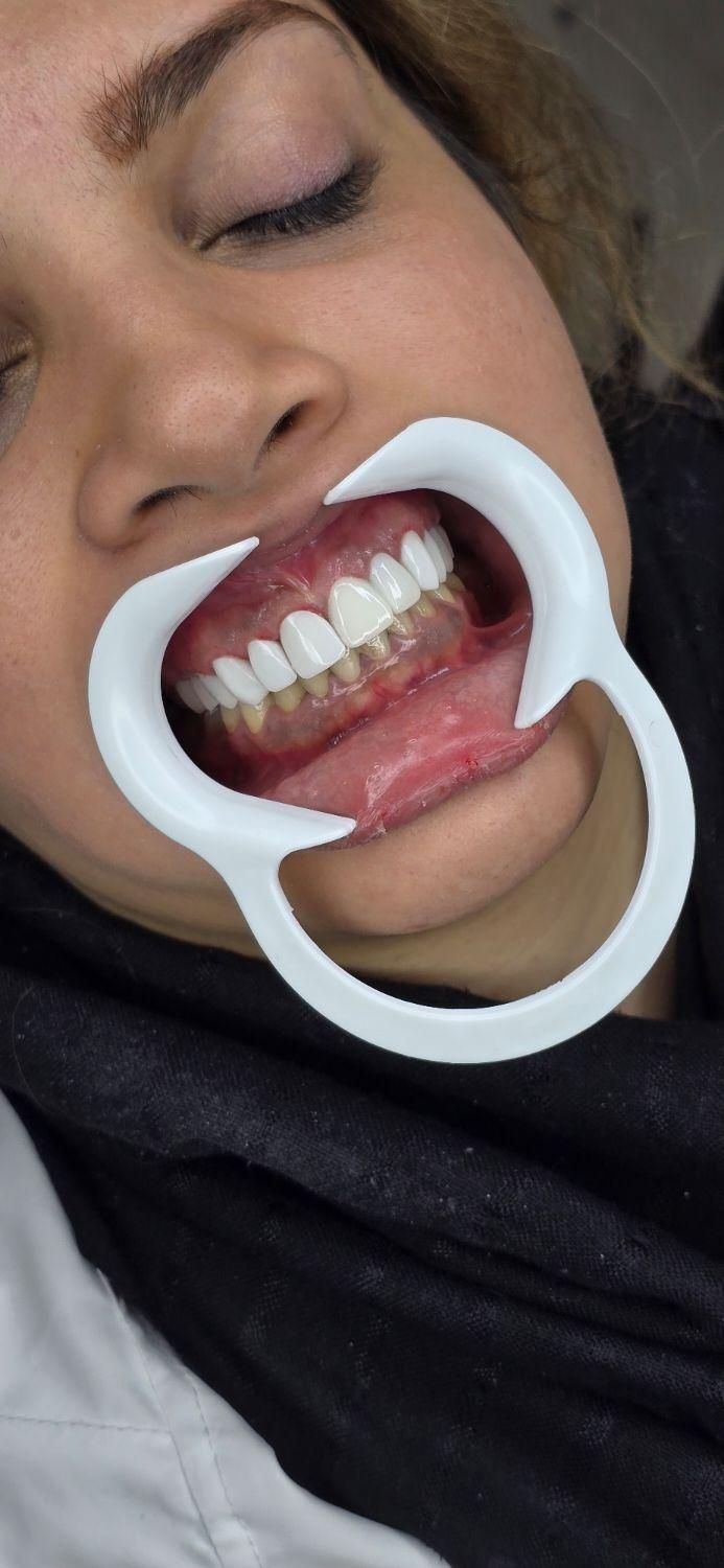 منشی دندانپزشکی|استخدام درمانی، زیبایی، بهداشتی|کرمانشاه, |دیوار
