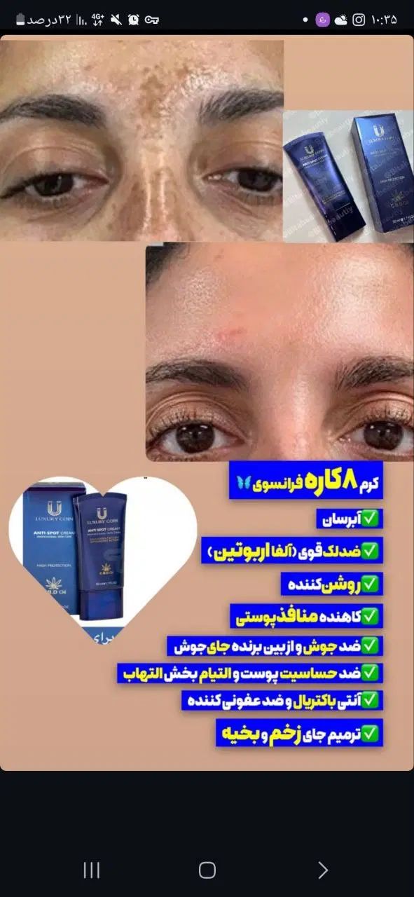 کرم ضدلک لاکچری کویین|آرایشی، بهداشتی، درمانی|کرج, شهرک اوج|دیوار