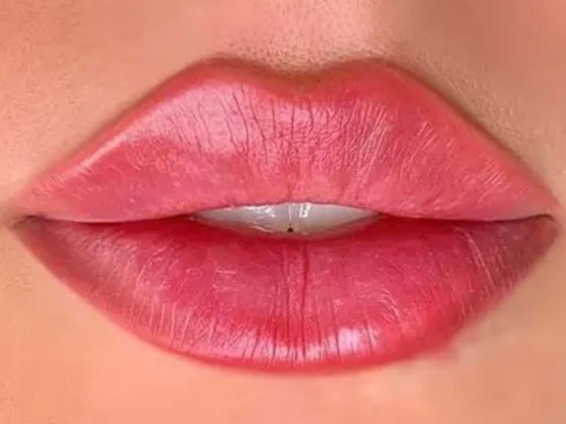 تزریق ژل و بوتاکس و فیلر بادی|خدمات آرایشگری و زیبایی|تبریز, |دیوار