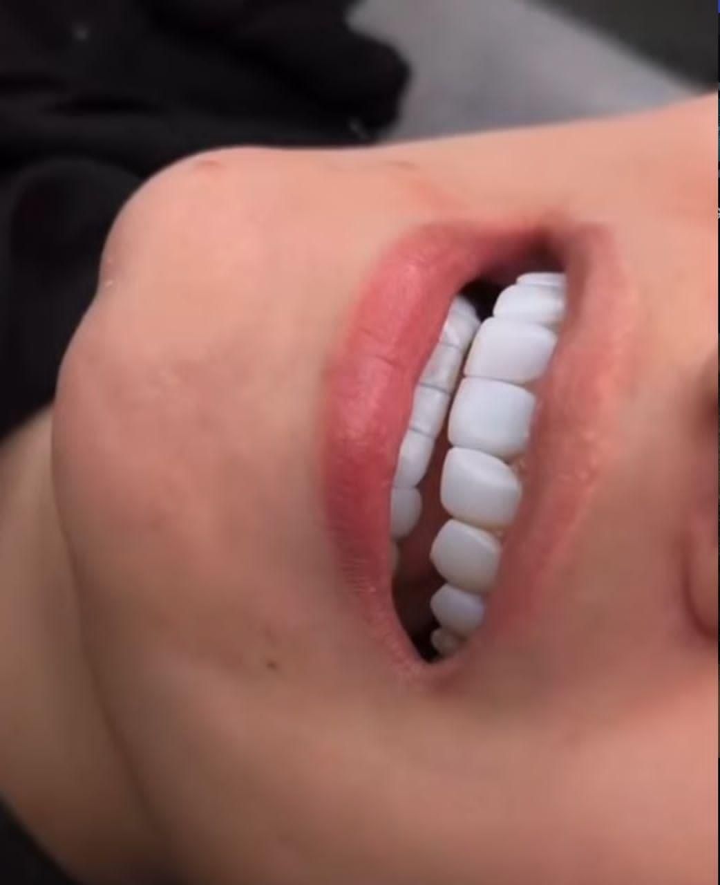 کامپوزیت ونیر|خدمات آرایشگری و زیبایی|شهریار, شهرک وائین|دیوار